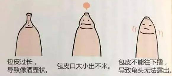 龟头口溢脓会自然好吗