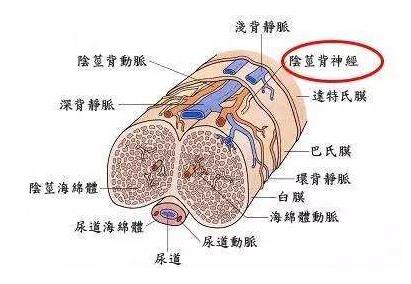 怎么预防龟头口溢脓