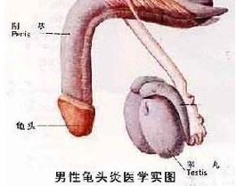 龟头口溢脓几天就好了？