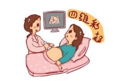 什么是四维彩超？