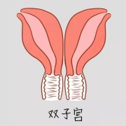 双子宫临床表现