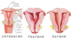 纵膈子宫症状表现