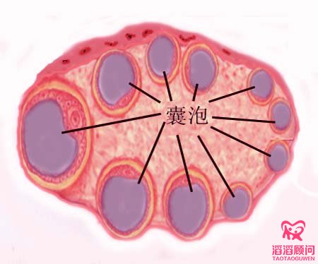 卵泡,怀孕,多囊卵巢