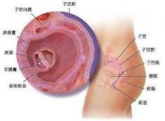 患上多囊卵巢可以做试管婴儿吗？