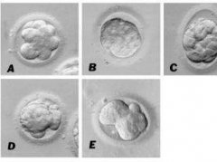 试管婴儿胚胎碎片多是男方问题还是女方问题？