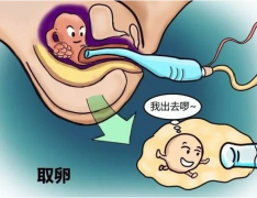 试管婴儿何时取卵？取卵时间有规定吗？