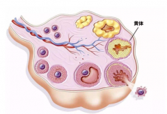 试管婴儿卵巢过度刺激，如何避免？